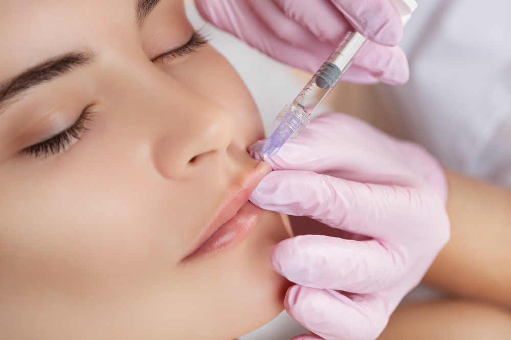 Lip Filler Injections in Murfreesboro