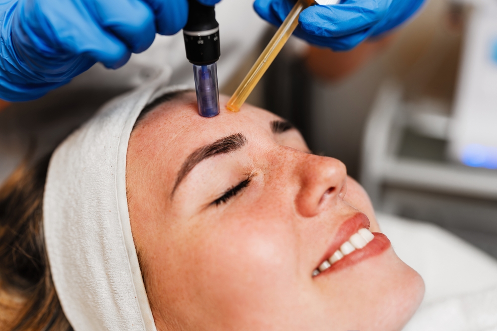 Microneedling Cost Murfreesboro Tennessee