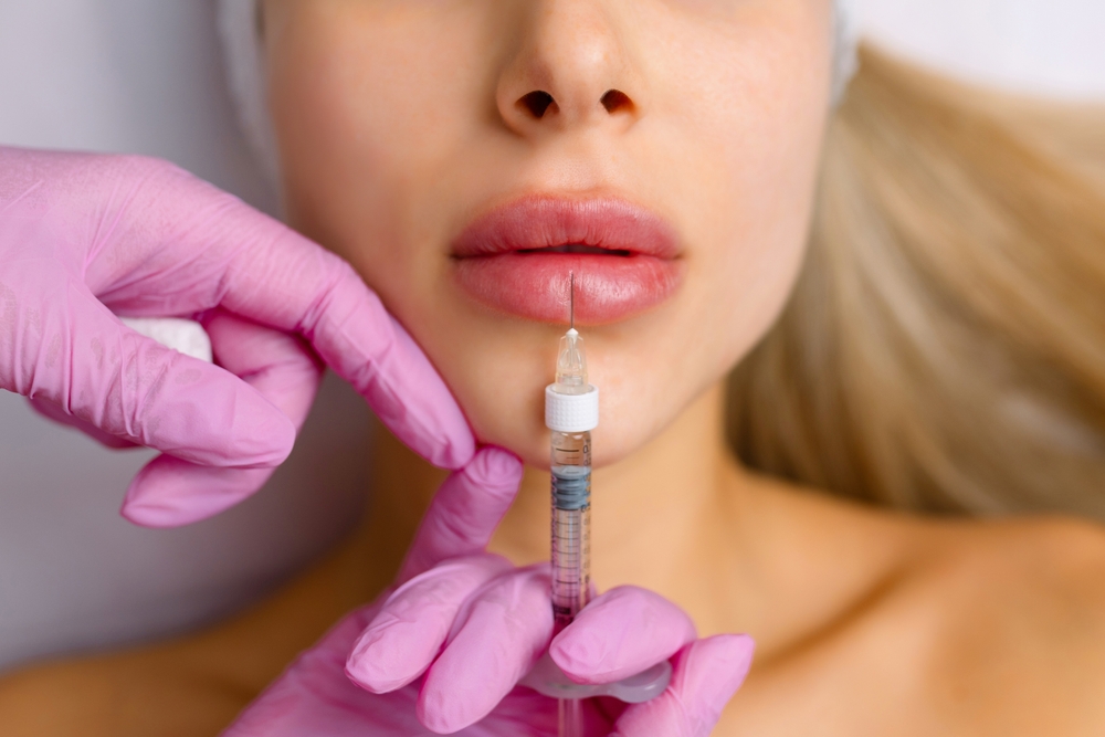 Lip Filler Treatments