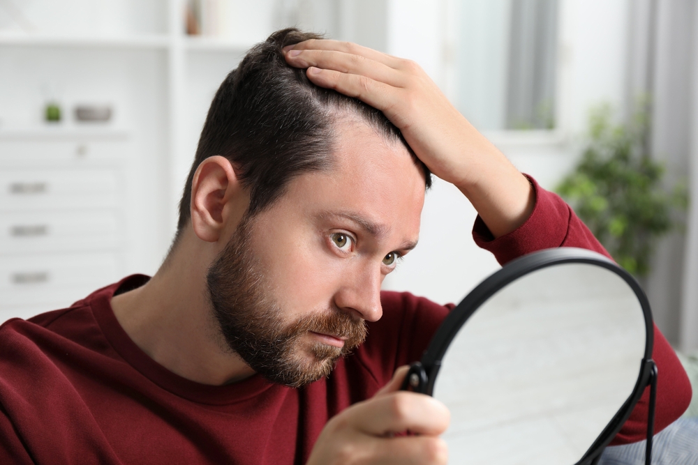 4 Reasons to Seek the Top Hair Loss Solutions and Specialist in Murfreesboro, Tennessee