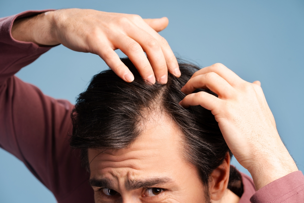 Best Hair Loss Specialist in Murfreesboro, Tennessee: PRP and Regenerative Treatment Options