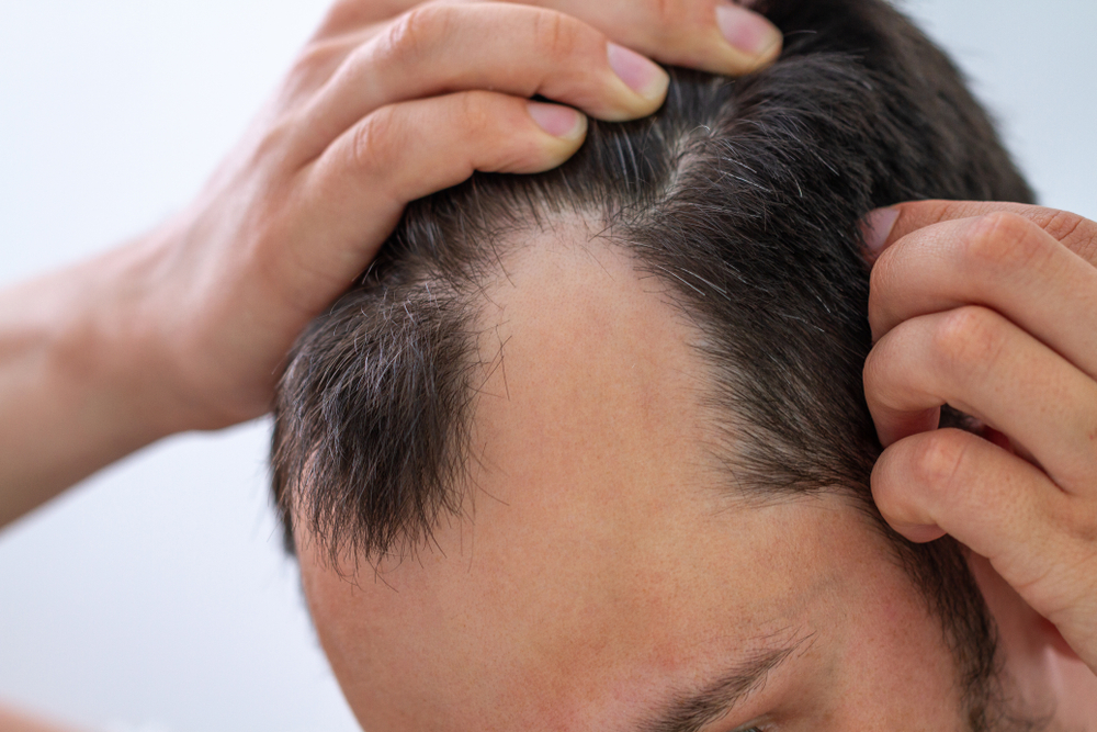 Book Your Hair Thinning Treatment Appointment Near Brentwood, Tennessee for a Fuller, Healthier Head of Hair