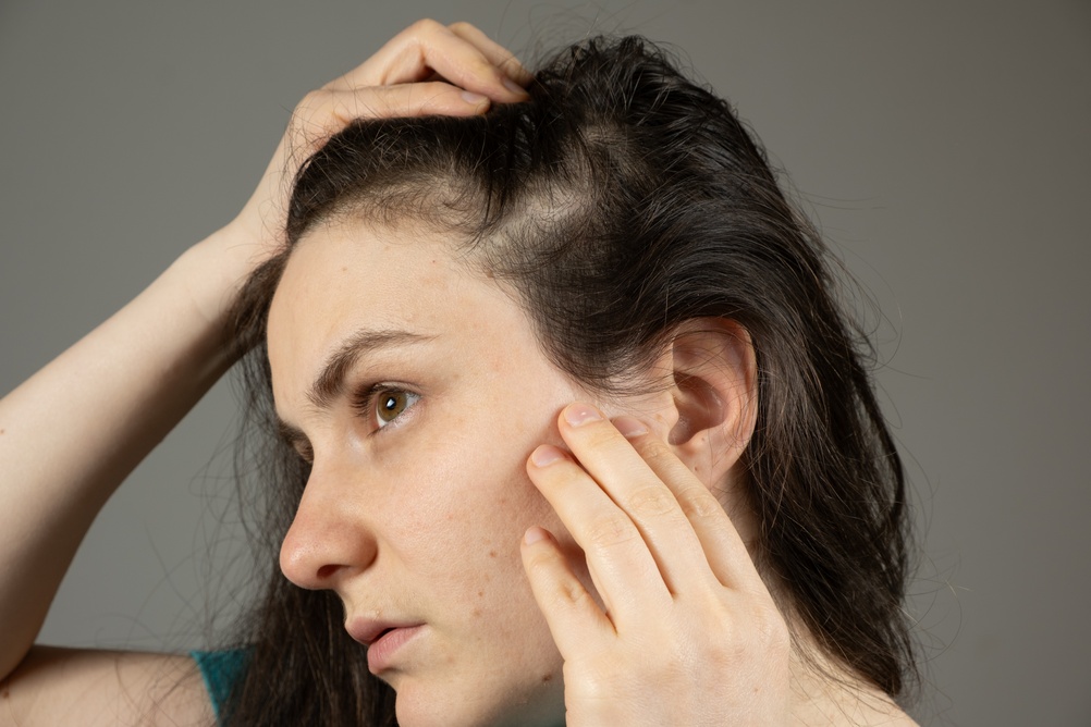 Hair Loss Specialist Consultations in Murfreesboro, TN for Thinning Hair and Scalp Concerns
